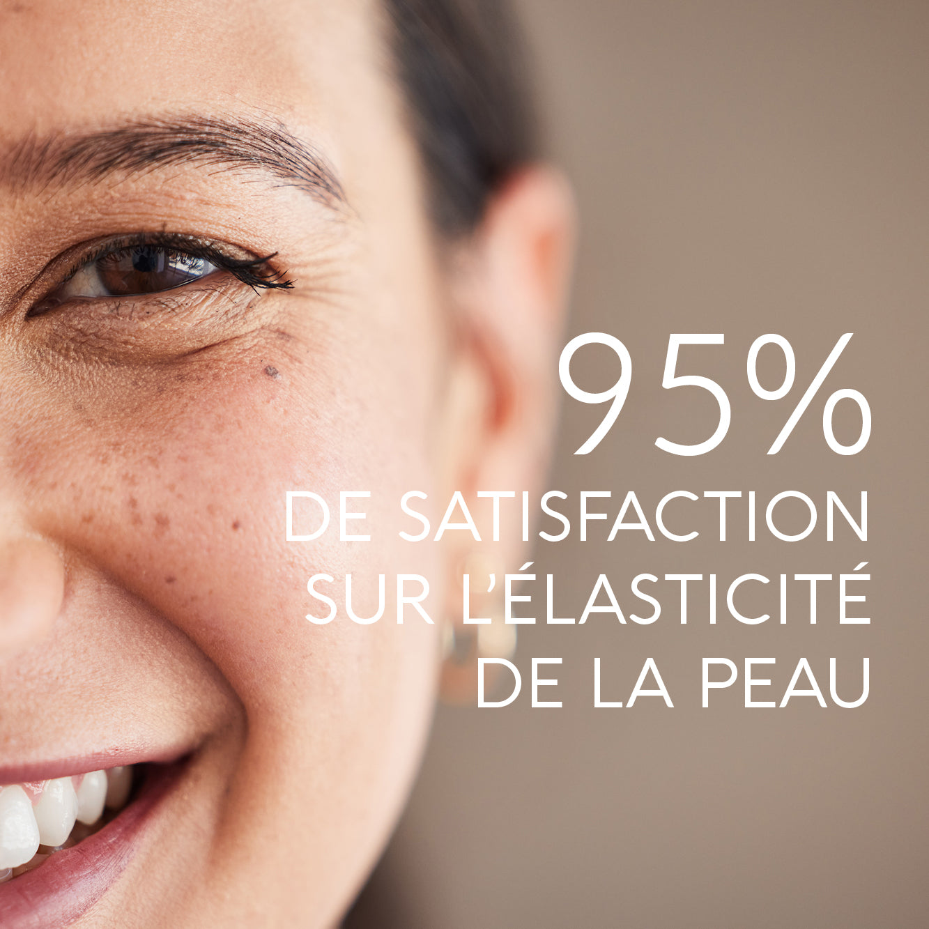 HYALURONIC FORTE 300 MG